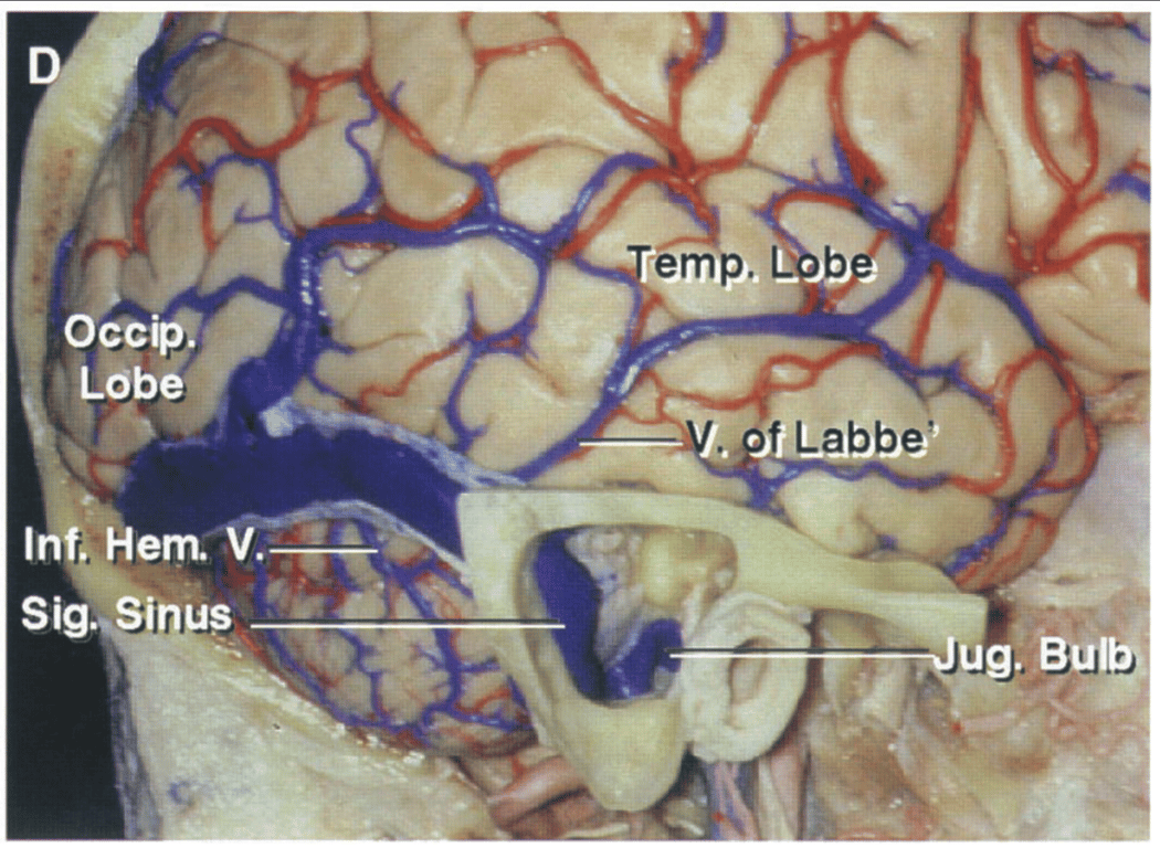 Lateral cerebral and cerebellar surfaces