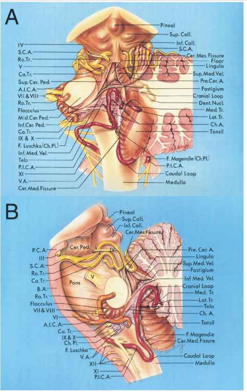 A, Posterior view with the left and part of the right half of the cerebellum removed. B, Lateral view with the left half of the cerebellum removed to expose the fourth ventricle. 