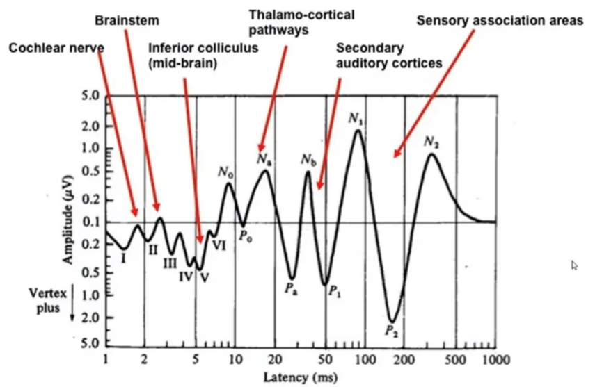 Vestibulocochlear Nerve - Techniques Brainstem Thalamo-cortical Sensory association areas pathways Cochlear nerv Inferior colliculus (mid-brain) 5.0 Secondary auditory cortices 2.0 1.0 0.5 0.2 0.5 Vertex 1.0 plus 2.0 5.0 1 2 5 10 20 so 100 200 soo 1000 Latency (ms) 