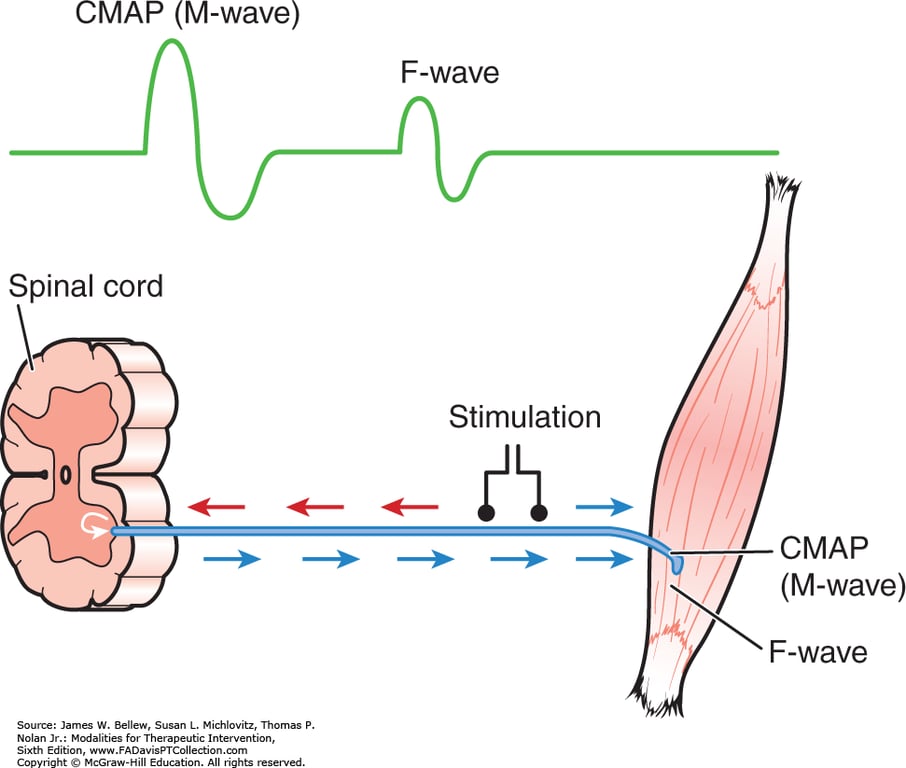 筋電図の基礎①：神経伝導検査の波形 | お医者さんのダイエット日記～よく食べ、よく泳ぎ～（＋医学、投資、雑学）