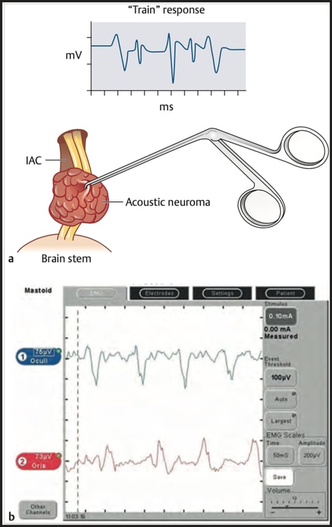 A screenshot of a medical device AI-generated content may be incorrect.