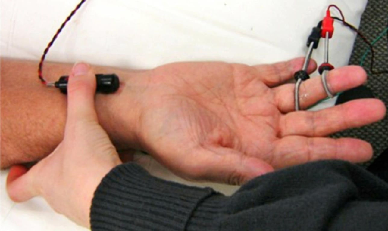 Close-up of a person's hand with a device attached to their wrist AI-generated content may be incorrect.