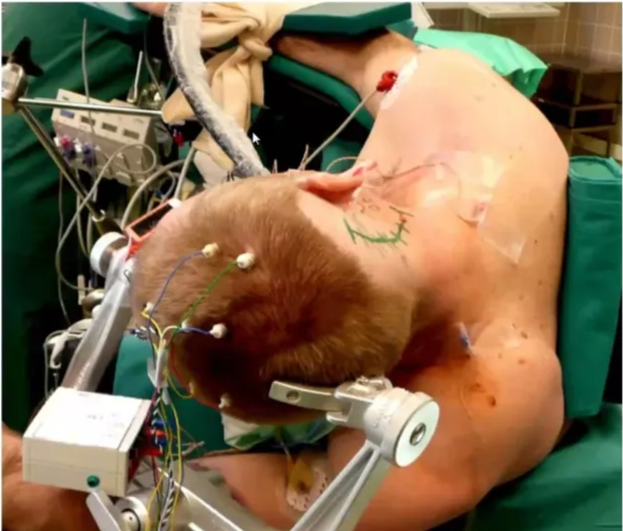 Vestibulocochlear Nerve - Techniques 