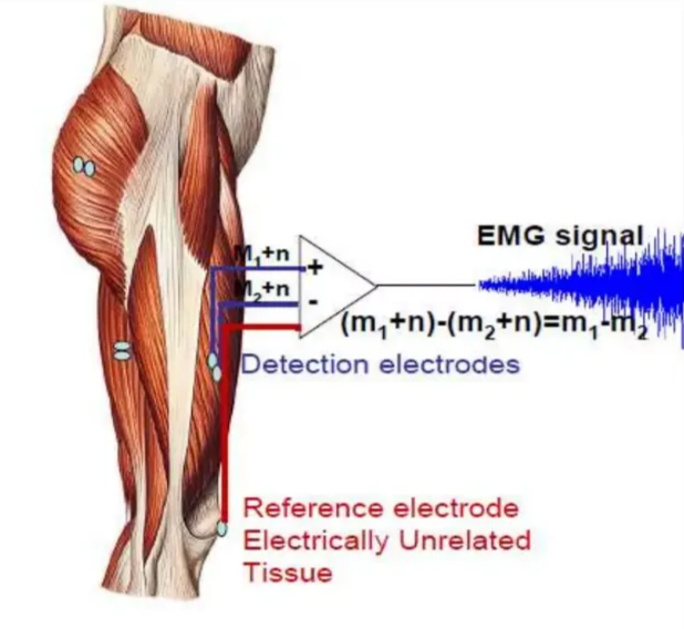 EMG Signal Capture •Input from two different points on the muscle •Close (usually 1-2 cm) •Electrode alignment with the direction of muscle fibers- increased probability of detecting same signal •Subtracts the two inputs •Amplifies the difference and EMG pattern recording EMG sig I Detection electrodes Reference electrode Electrically Unrelated Tissue 