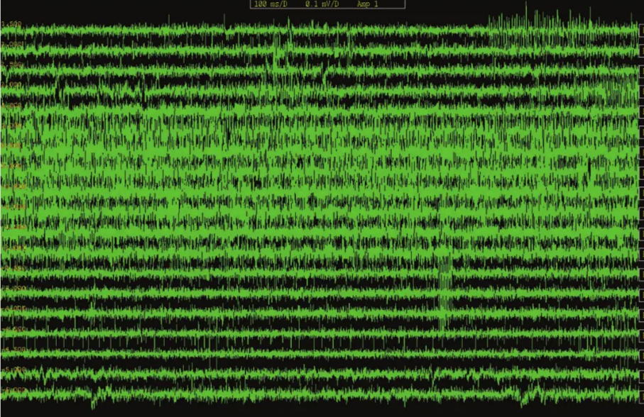 A green screen with black background AI-generated content may be incorrect.