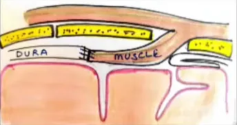 A diagram of a human body AI-generated content may be incorrect.