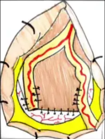 A diagram of a person's body AI-generated content may be incorrect.