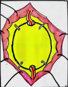 A diagram of a human body AI-generated content may be incorrect.