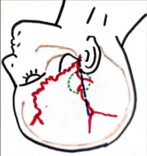 A close-up of a diagram AI-generated content may be incorrect.
