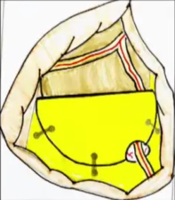 A diagram of a person's body AI-generated content may be incorrect.