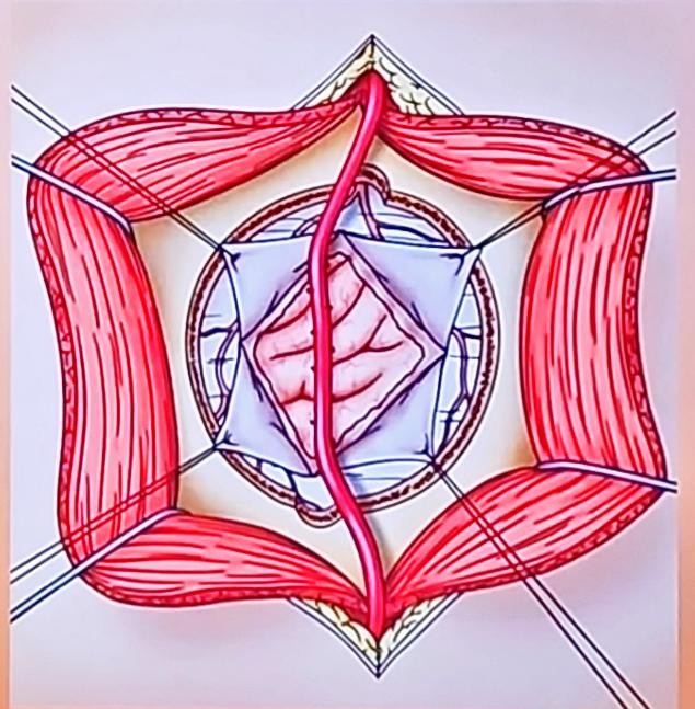 A drawing of a human body AI-generated content may be incorrect.