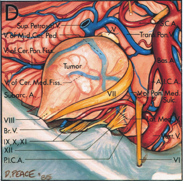 - Титог d. Fiss._,— Мо Роп. е Вг.М PlC.A. 