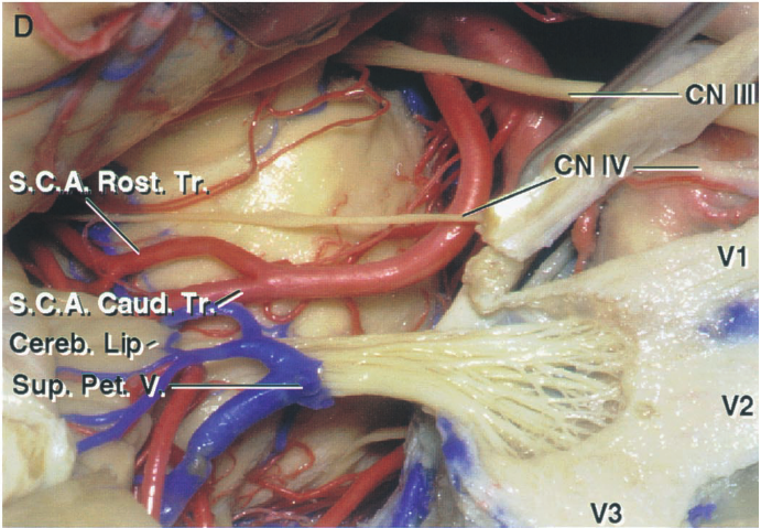 CNI S.C.A. R .C;AÆaud. Cereb. Lip- su . 