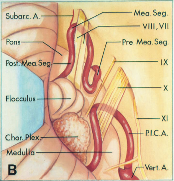 Subarc. A. Pons Pos . . Seg Flocculus Chor ex edu Mea. Seg. VIII , VII Pre. Mea. Seg. IX x XI PIC.A. Vert. A. 