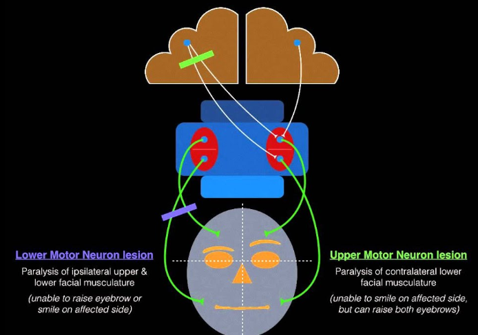 A diagram of a brain AI-generated content may be incorrect.