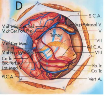 Cer Pon Fiss. Mid.Cer Pee. flocculus Porn. M Cho r. Cerfbn Fi V. of R)n. V.of Mid.Cer VSE C Lai Med. r ped. Carr V ns. pon.V V of Cer. .ic.A. sc.A. AICA. VII,VIII Wrt.A. S.C.A. sal V Vert A, 