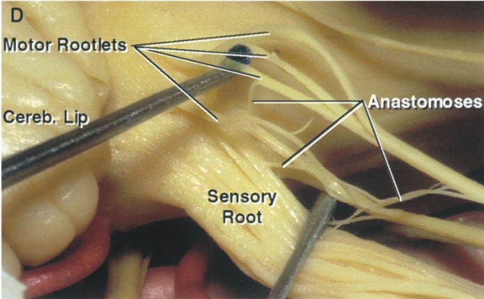 Motor Rootlets nastomoses Cereb. Lip Sensory Root 