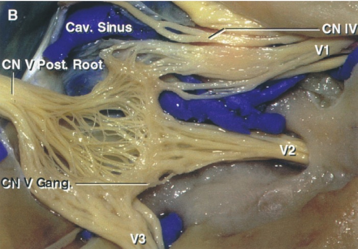 CN IV CN C Cav. Shus ost Root Gang. 