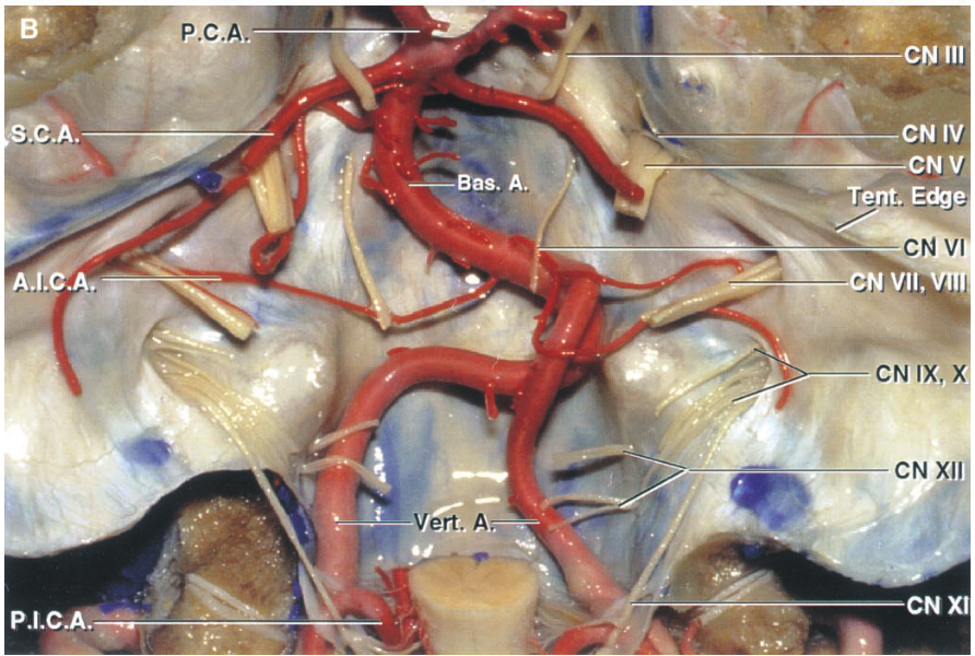 Close-up of a human body anatomy AI-generated content may be incorrect.