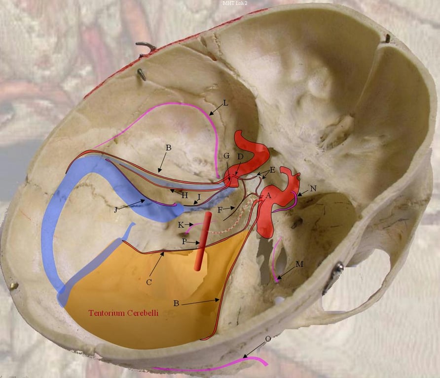 Only half the tent is drawn here. The checkered vessel connecting MHT with the Basilar Artery (P) is the Trigeminal Artery, which may come off the MHT or ILT.
