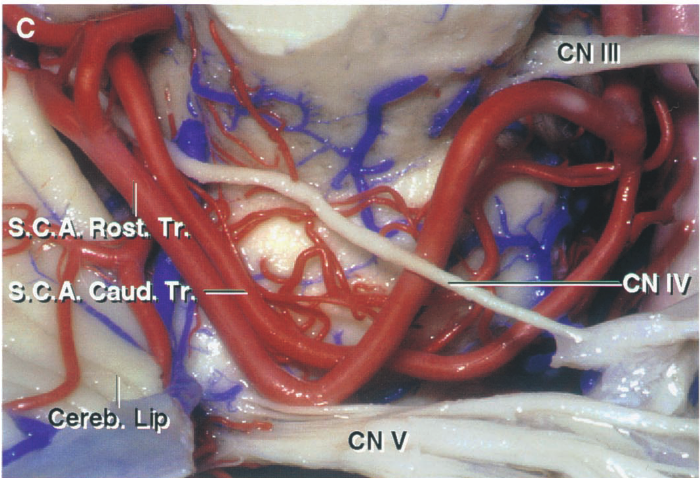 CN III S.C. st Tr. A±aud.Tr. — _ ere 