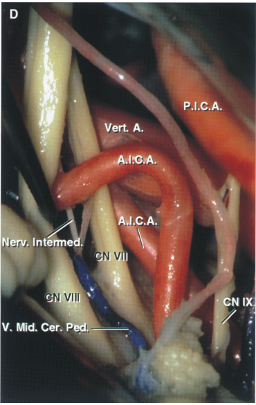 Close-up of a human body anatomy AI-generated content may be incorrect.