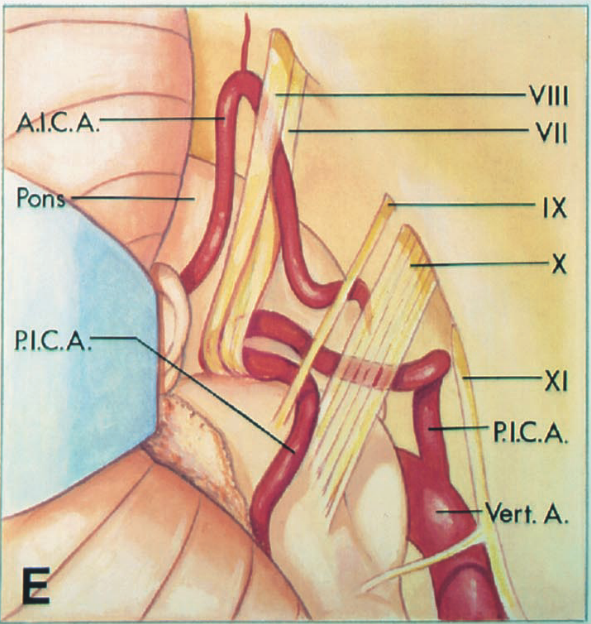 Vlll Vll ТС.А. РС.А. Vert. А. 