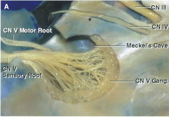 CN V Motor Root N Ill MeckeI's•Cåv CN V Gang 