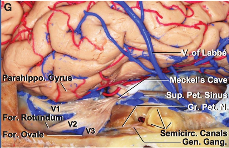 ŕahłppo For. o Forxo ru o abbć ÓkePs Cave Pet. Sinu Gen. Gang 