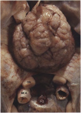 Close-up of a human body anatomy AI-generated content may be incorrect.