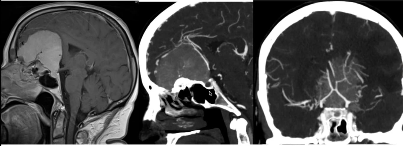 A close-up of a brain scan AI-generated content may be incorrect.