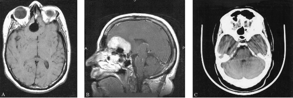 A close-up of a brain scan AI-generated content may be incorrect.
