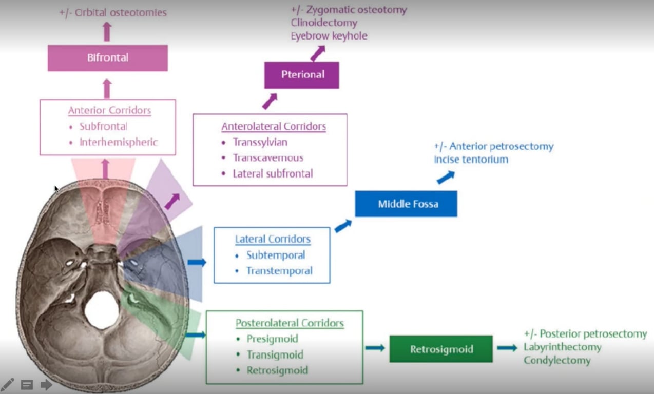 +1• Orbital osteotomles Blfrontal Anteri01 Corridors • Subfrontal • Interhernispheric Zygomatic osteotomy Clinoidectomy Eyebrow keyhole Pterional Anterolateral Corridors • Transsylvian • Tldnscavemous • lateral subfrontal lateral Corridors • Subtemporal • Transternpordl Posterolateral Corridors • PI esigmoid • Transiqmoid • Retrosigmoid Anterior petrosectomy Incise tentorium Middle Fossa Retrosigmoid +1- Posterior petrosectomy Labyrinthectomy Condylectomy 