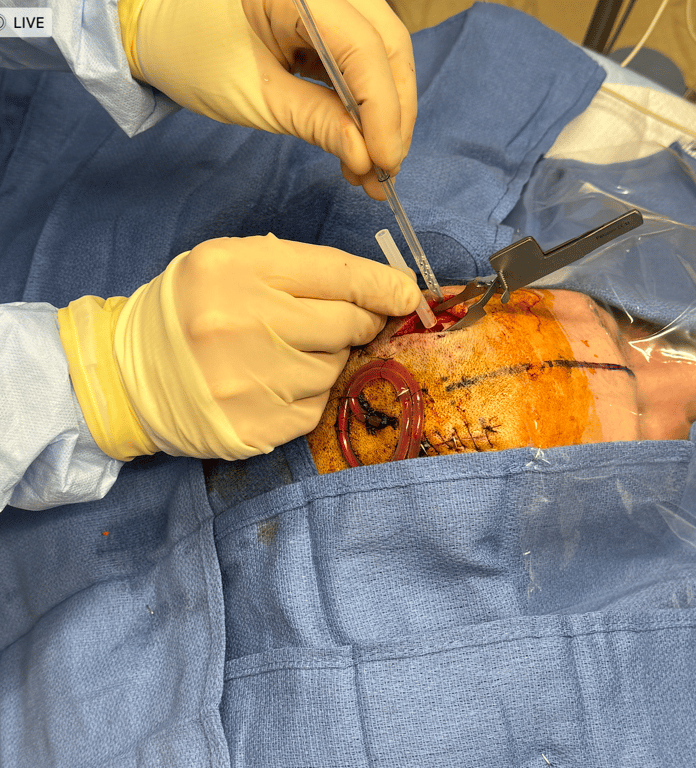 To help ensure perpendicularity of your angle, you could consider using the weapon safety cap as a guide.