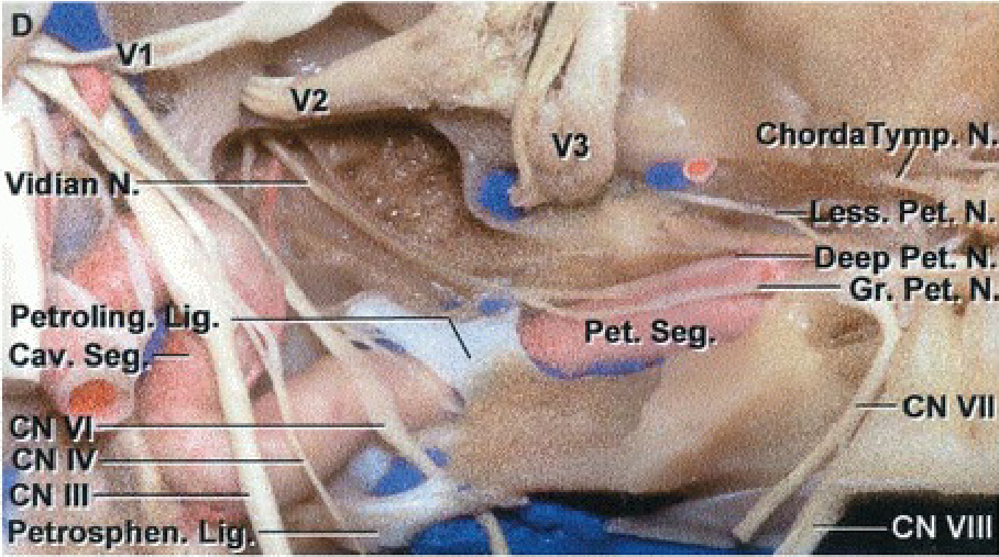 ChordaTymp.i Vidian pet. '—Gr. Pet,N. Petroling. g. Cav. Seg Pet. seg.w CN Vill 