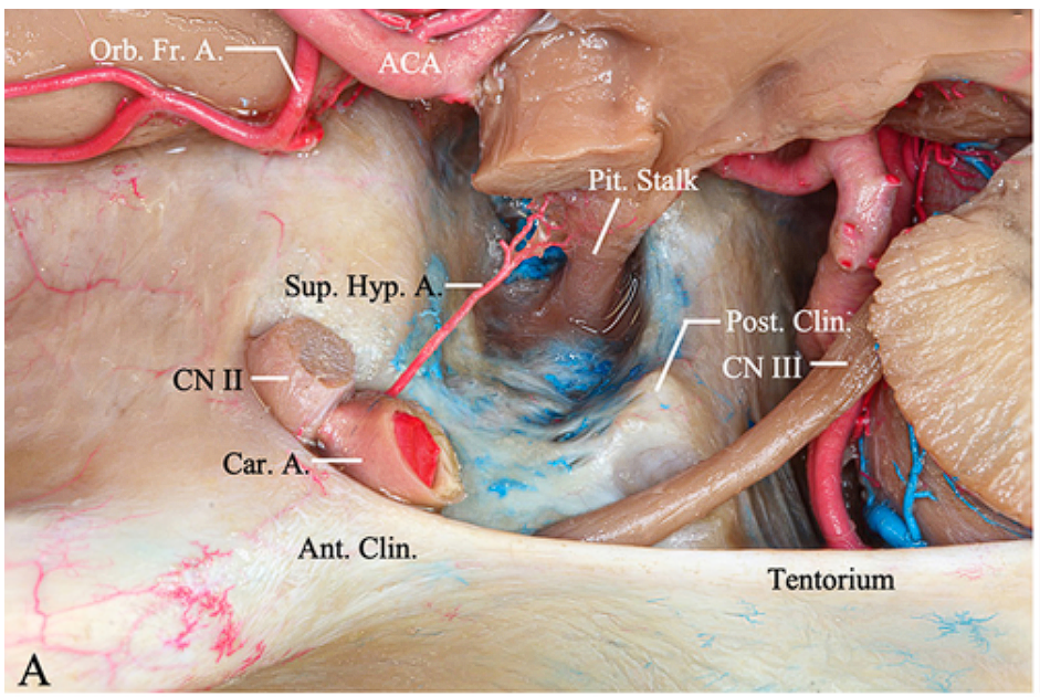 A close-up of a human body AI-generated content may be incorrect.