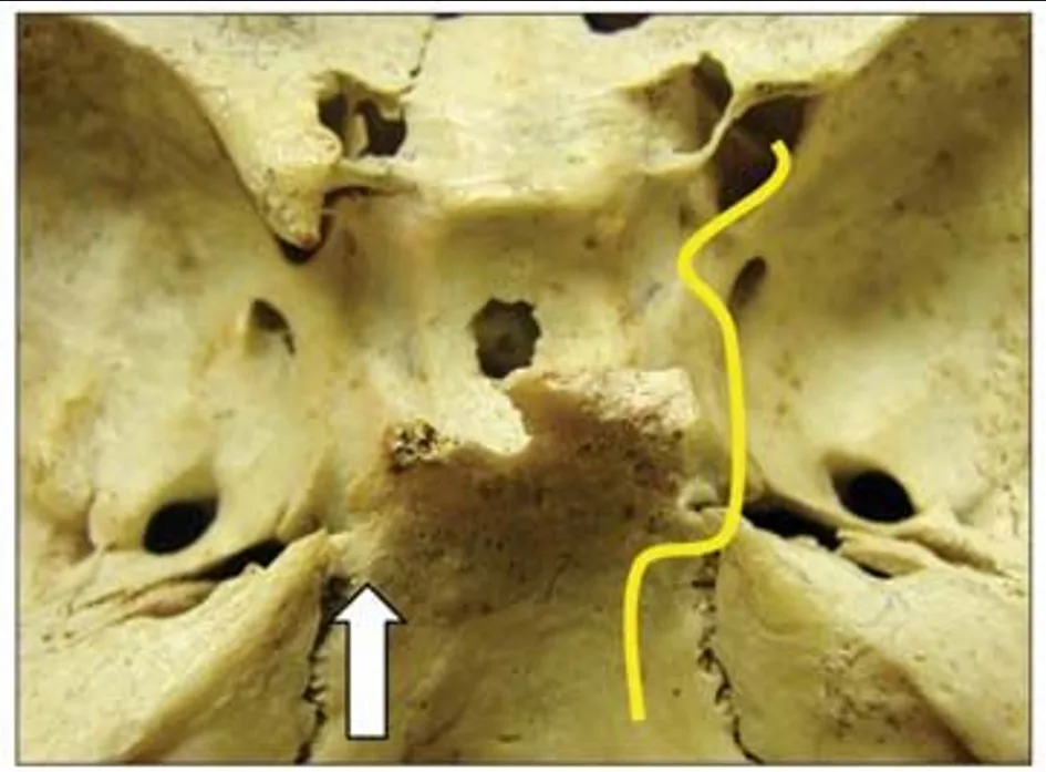 Superior view of the sellar region and its related bone structures. 