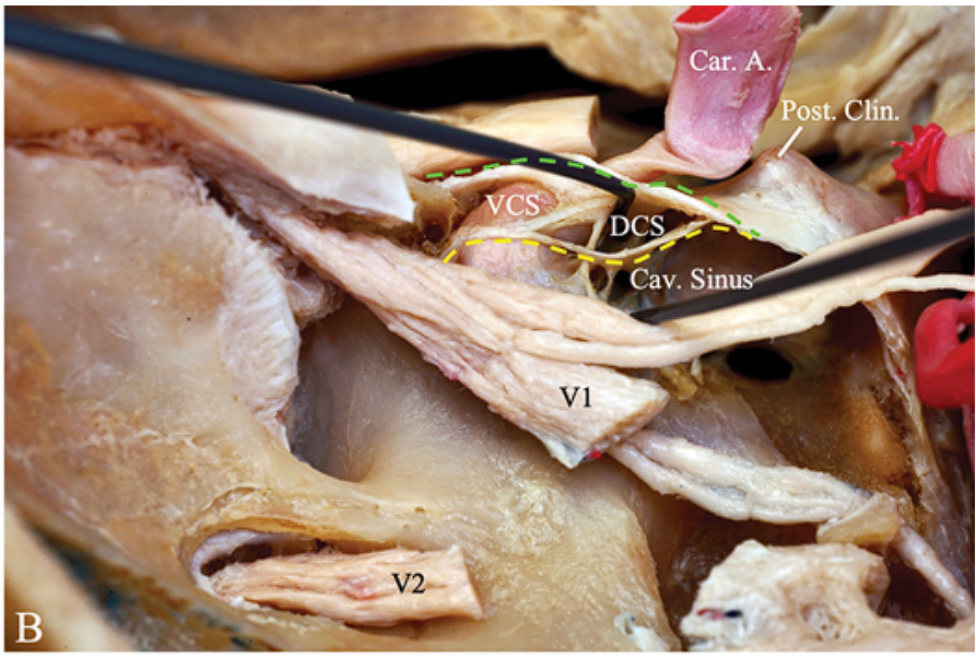 v.cß Car. A. Cav. S• 