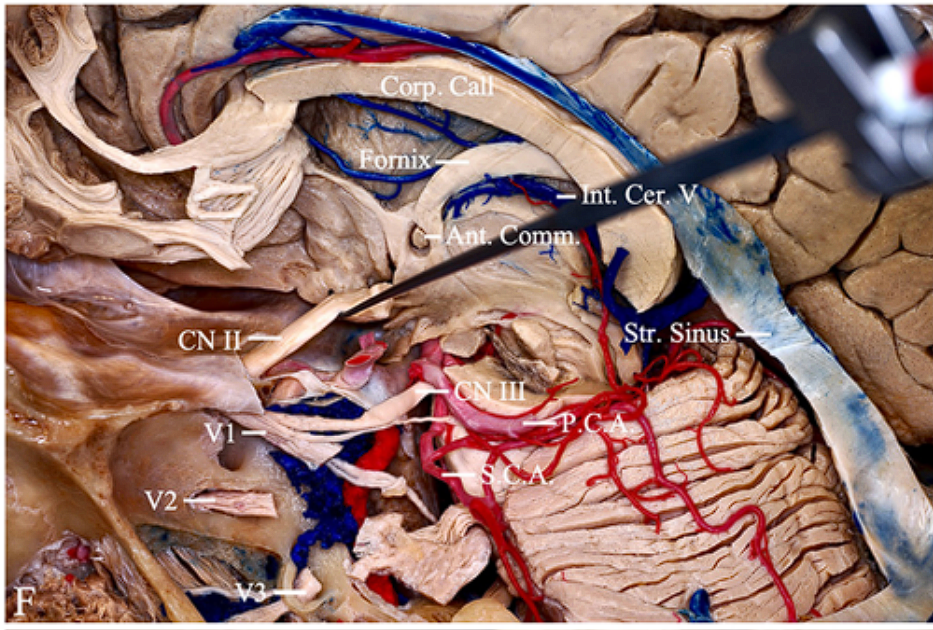 A close-up of a human brain AI-generated content may be incorrect.