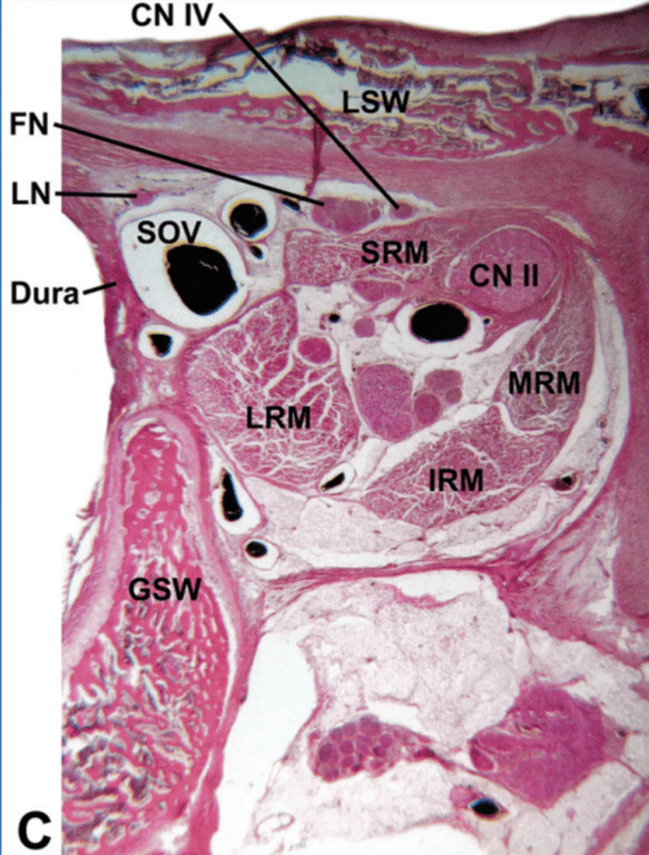 The lateral narrow part of the SOF