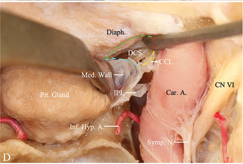 •dlllks •ΙΙΌ • lldV!Cl 
