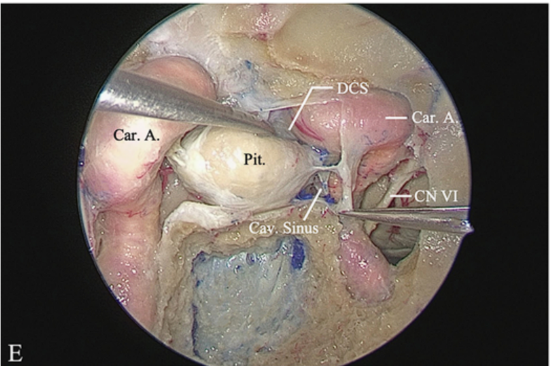DCS.' Car. A. Pit. ) CNVI 