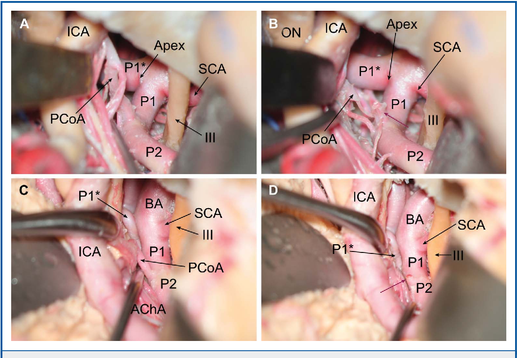 Close-up of several images of a person's body AI-generated content may be incorrect.