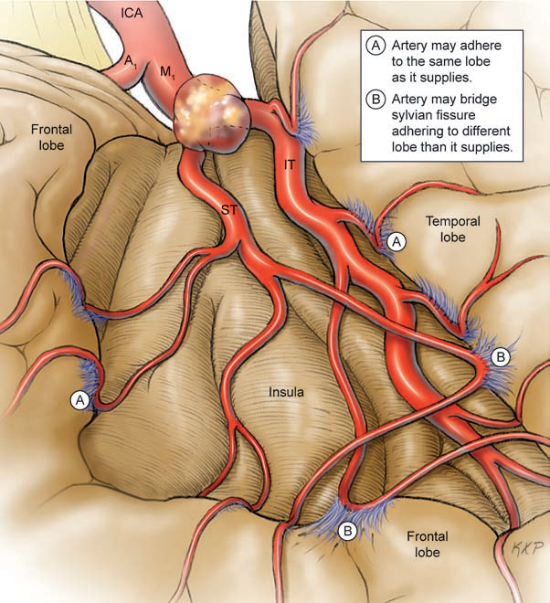 A diagram of the heart and arteries AI-generated content may be incorrect.