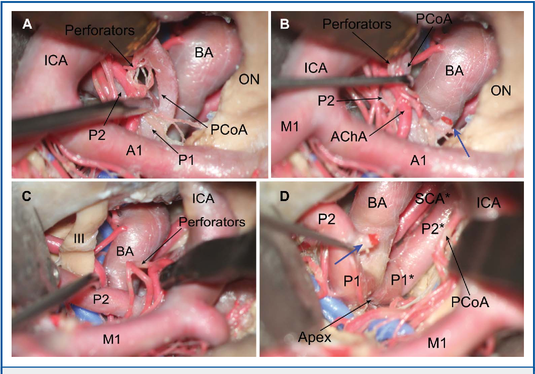 Close-up of several images of human organs AI-generated content may be incorrect.