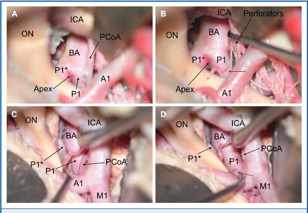 Close-up of several images of human body AI-generated content may be incorrect.
