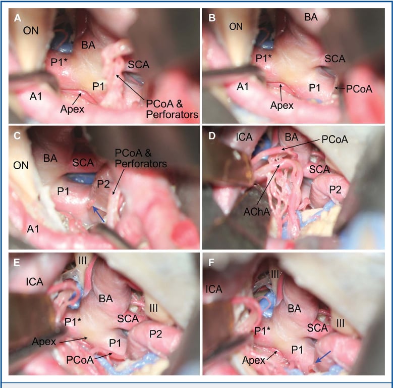 Close-up of several images of the inside of a human body AI-generated content may be incorrect.