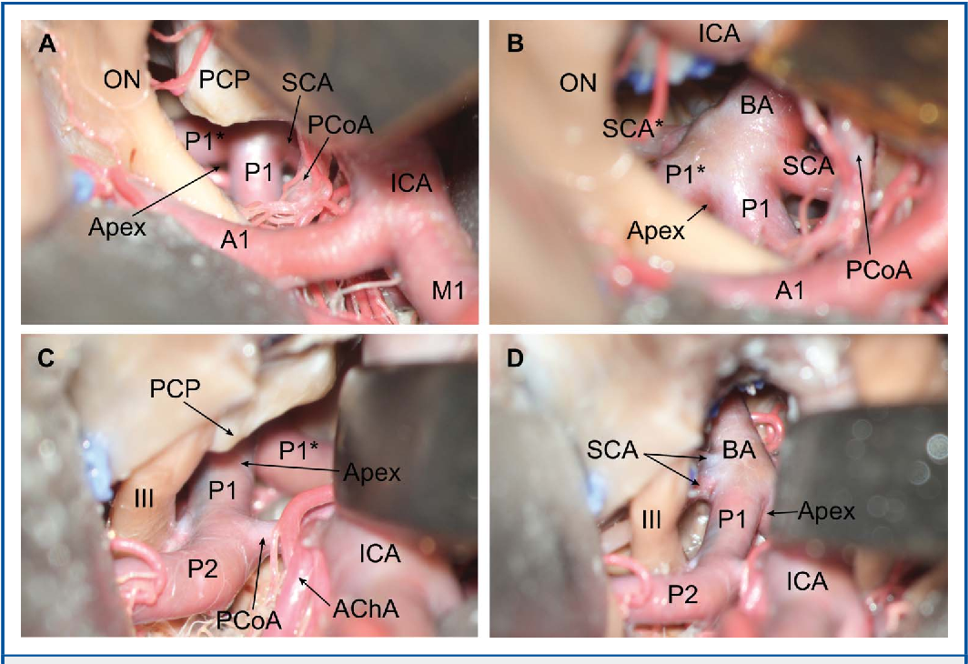 Close-up of several images of a human body AI-generated content may be incorrect.