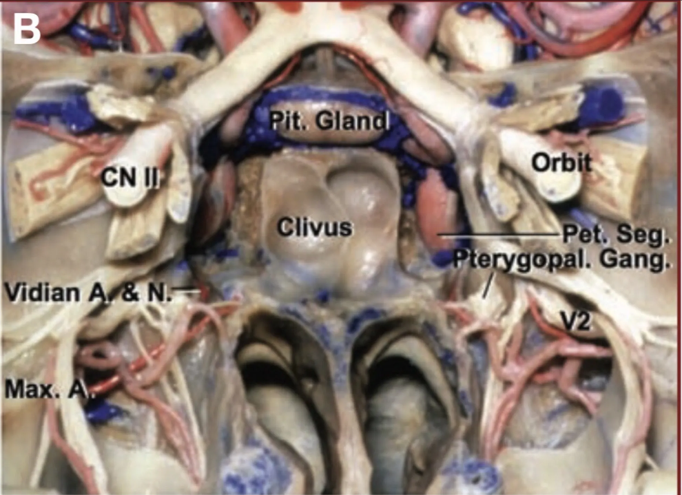 Neurovascular structures coursing along the surface of the sphenoid bone. 