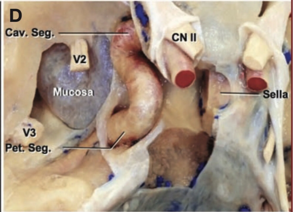 Superior view of the floor of a left middle fossa. 
